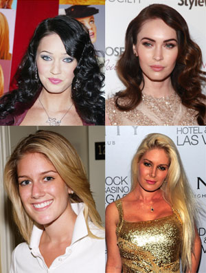Shocking celeb cosmetic surgery: Before and after
