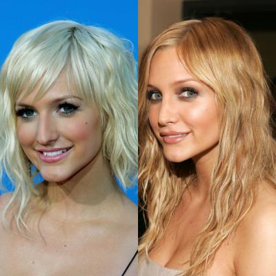 Celebrity plastic surgery