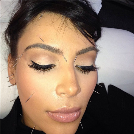 Kim Kardashian shows off her needle studded face in new Instagram snap