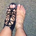 Kim Kardashian swollen feet