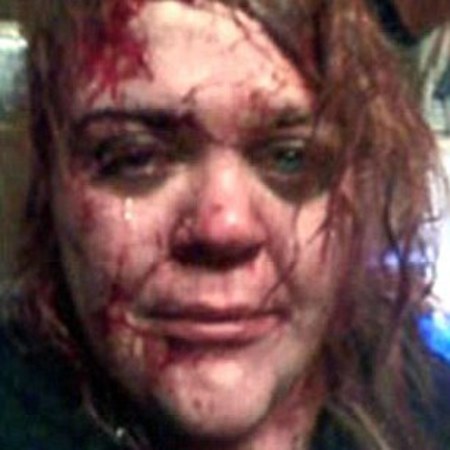 Woman turns to Facebook for help after savage domestic violence attack - social media - domestic violence - women's rights - world news - life news - handbag.com