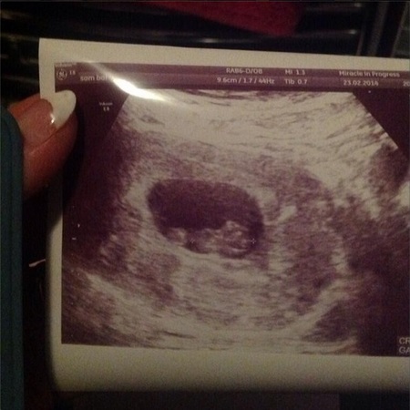 Sam Bailey's Instagram baby scan - meet peanut - baby - news - celeb fashion news - handbag.com